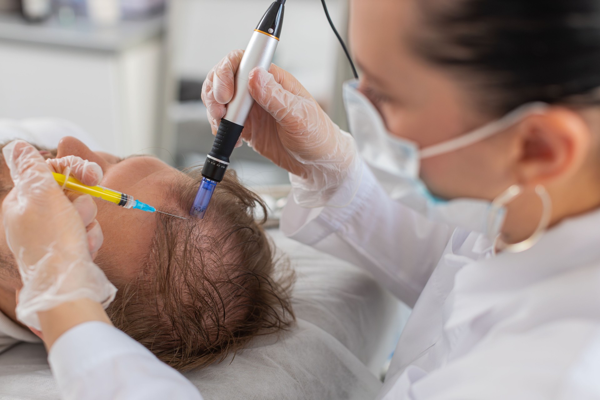 Trichologist doing man hair regeneration procedure dermapen microneedling vitamin exosomes injection